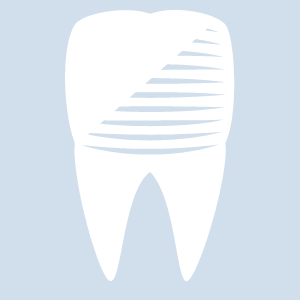 Zahn verfärbt sich grau nach wurzelbehandlung